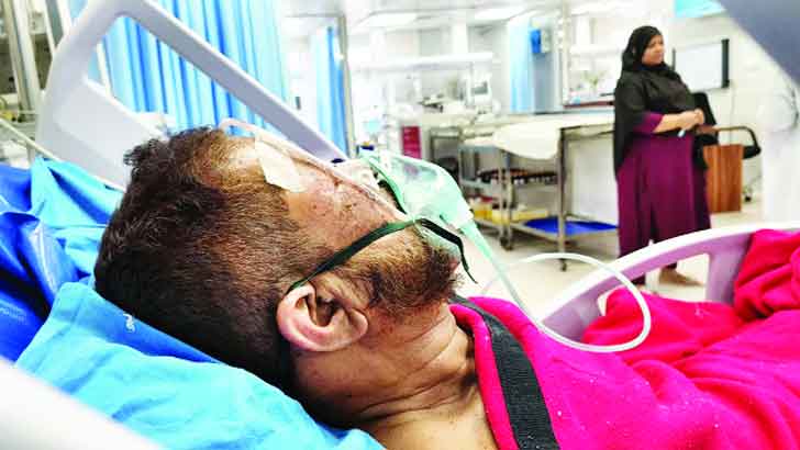 Read more about the article ডিপোর আগুনে ৬৩ জনের চোখ আঘাতপ্রাপ্ত