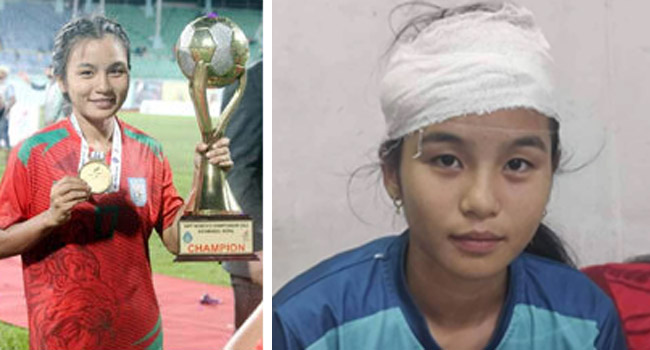 Read more about the article ছাদখোলা বাস থেকে অ্যাম্বুলেন্সে হাসপাতালে ঋতুপর্ণা চাকমা