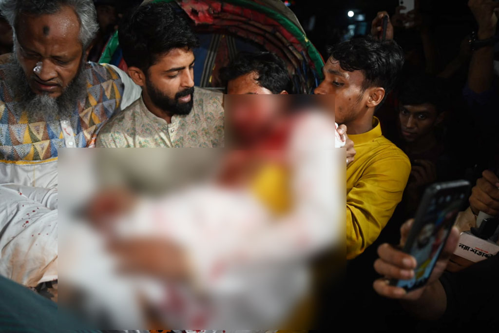 Read more about the article নুরের মাথা, নাক ও চোয়ালের হাড় ভেঙে গেছে