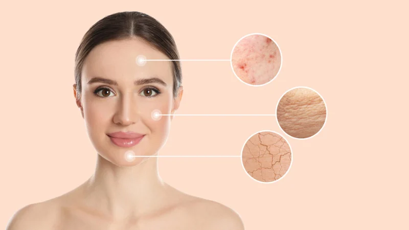 Read more about the article ত্বক তৈলাক্ত, শুষ্ক না স্পর্শকাতর? ঘরে বসেই পরীক্ষা করুন