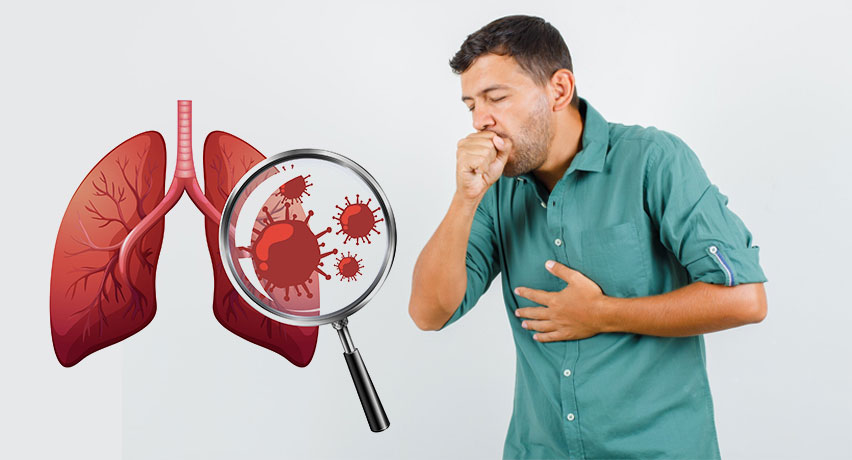 Read more about the article অর্থায়ন ও ওষুধ সংকটে যক্ষ্মা নিয়ন্ত্রণে হোঁচট, হামের মতো বড় প্রাদুর্ভাবের শঙ্কা